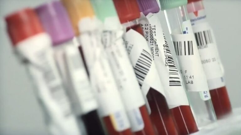 Blood Samples in Test Tubes, Commonly Used for Analyzing Alcohol Levels, Related to Refusing a Blood Alcohol Test